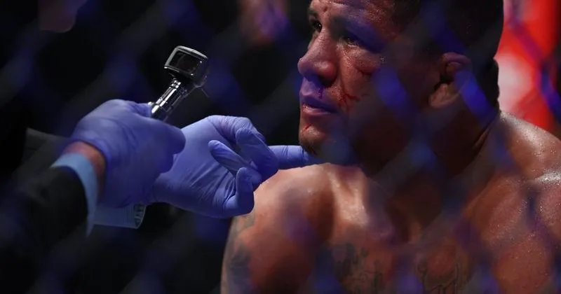 Gilbert Burns UFC cayó por nocaut ante Mike Malott en Winnipeg, sumó su quinta derrota seguida y vio a Malott mejorar a 7-1 en UFC.